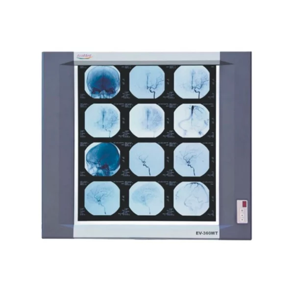 NEGATOSCOPIO LED SENCILLO EV-360MT ROYAL MEDITECH