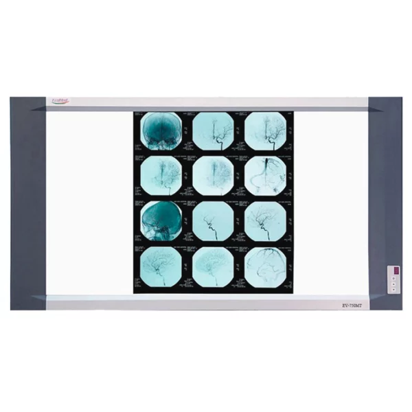 NEGATOSCOPIO LED DOBLE EV-750MT ROYAL MEDITECH
