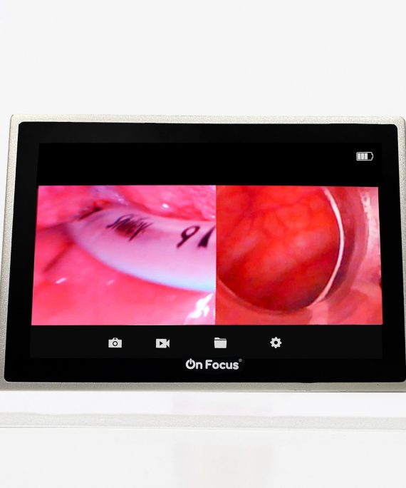 PANTALLA ONFOCUS ADVANCE DUO