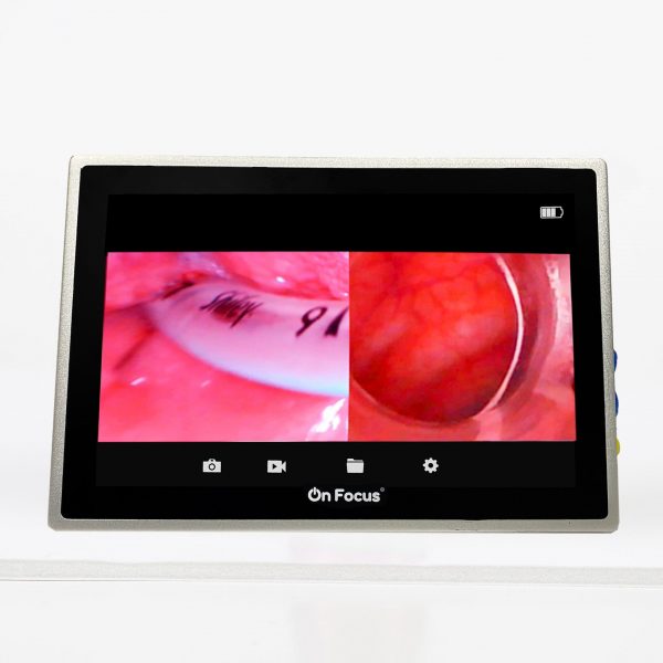 PANTALLA ONFOCUS ADVANCE DUO