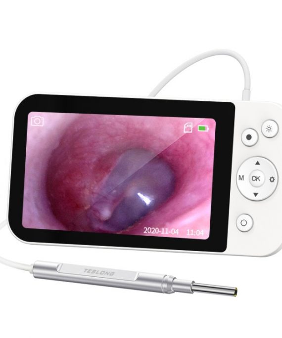 VIDEO OTOSCOPIO DIGITAL CON PANTALLA HD TESLONG MS500
