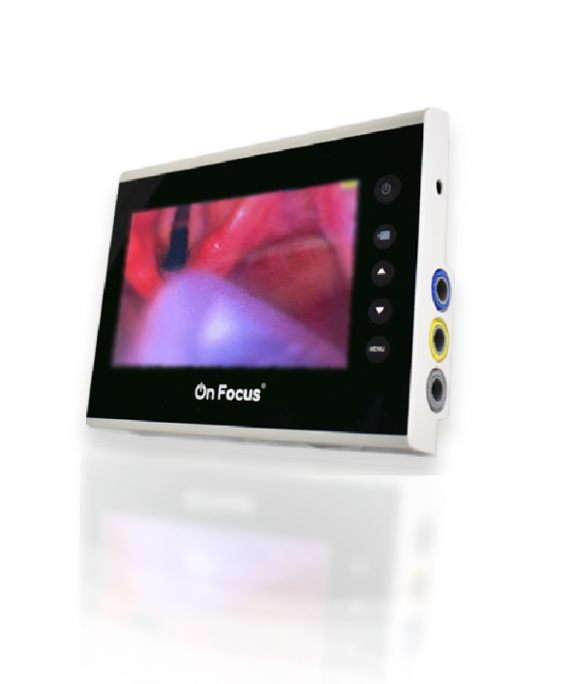 PANTALLA ONFOCUS ADVANCED