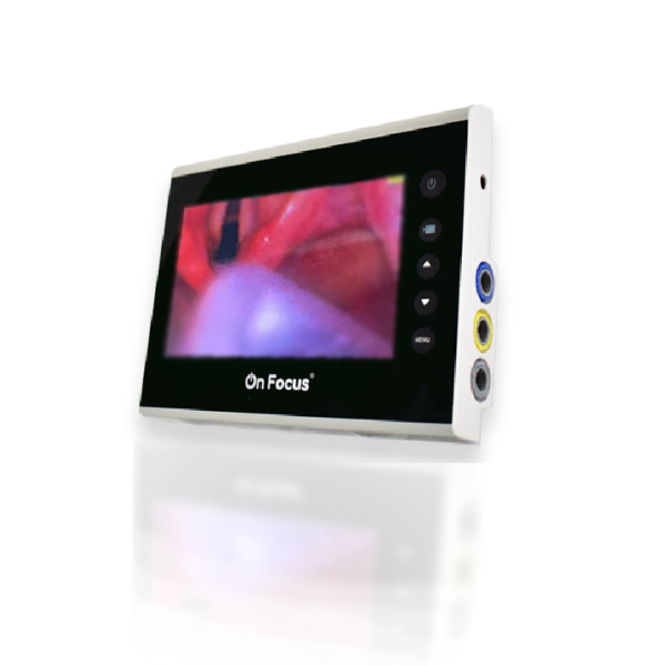 PANTALLA ONFOCUS ADVANCED
