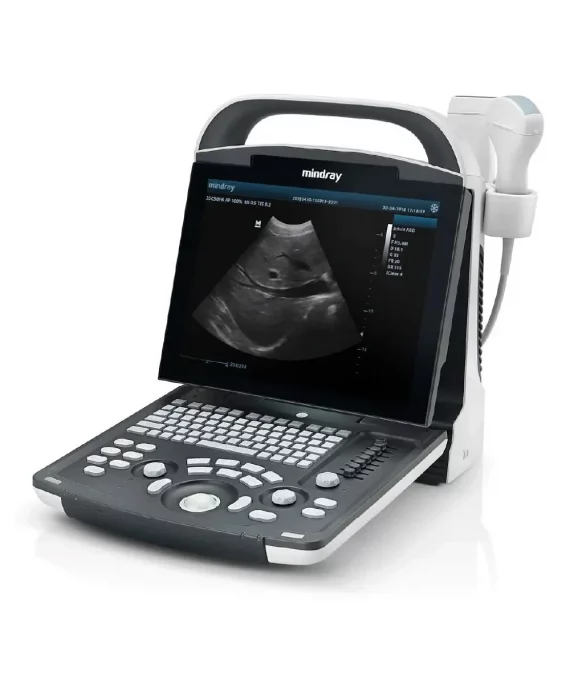 ULTRASONIDO PORTÁTIL DP20 MINDRAY
