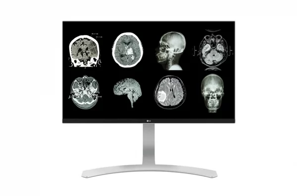 MONITORES DE DIAGNÓSTICO PARA RADIOLOGÍA LG 27HJ712C-W